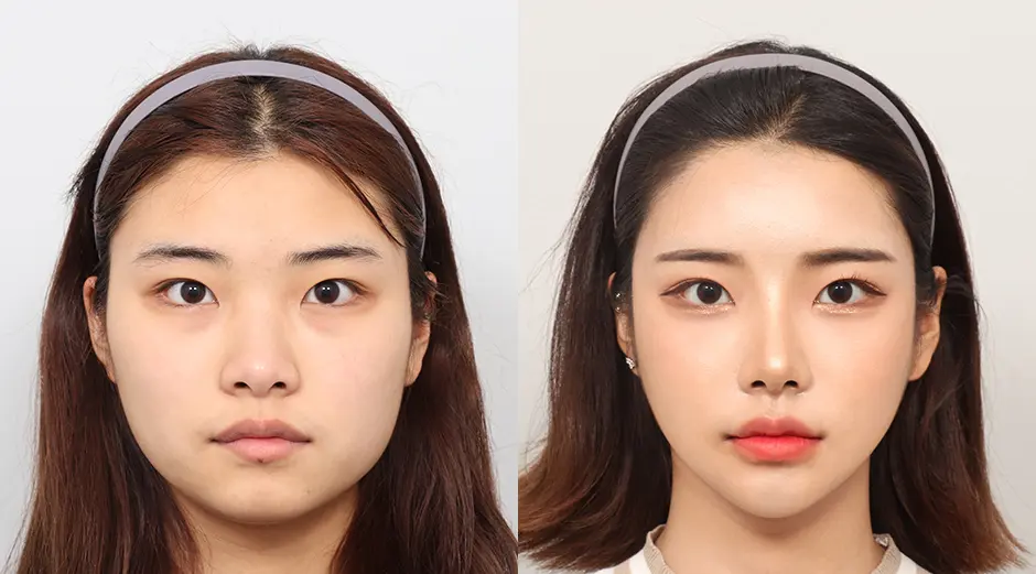Kecantikan Ideal Harus Berjalan Seiring dengan Keamanan